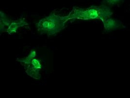 MMACHC Antibody in Immunocytochemistry (ICC/IF)