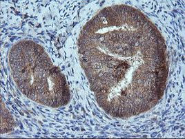 MMACHC Antibody in Immunohistochemistry (Paraffin) (IHC (P))