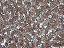 MMACHC Antibody in Immunohistochemistry (Paraffin) (IHC (P))