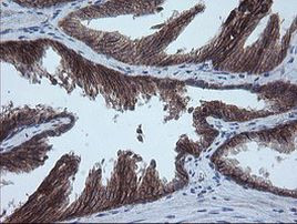 MMACHC Antibody in Immunohistochemistry (Paraffin) (IHC (P))