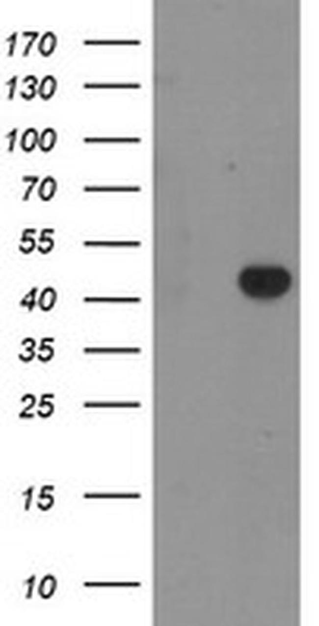 RAB3IL1 Antibody in Western Blot (WB)