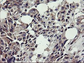 UBE2J1 Antibody in Immunohistochemistry (Paraffin) (IHC (P))