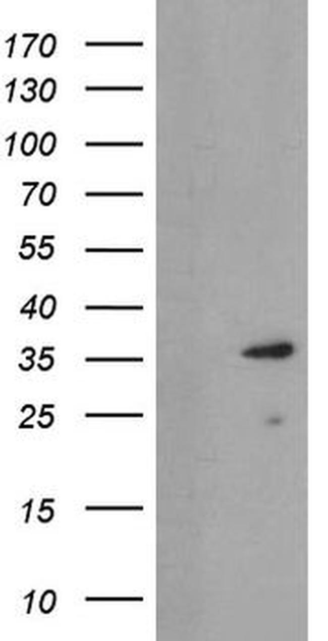 UBE2J1 Antibody in Western Blot (WB)