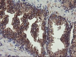 UBE2J1 Antibody in Immunohistochemistry (Paraffin) (IHC (P))