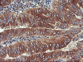 UBE2J1 Antibody in Immunohistochemistry (Paraffin) (IHC (P))