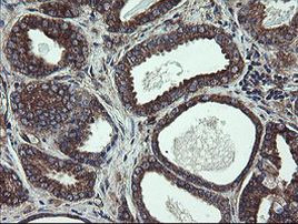 UBE2J1 Antibody in Immunohistochemistry (Paraffin) (IHC (P))