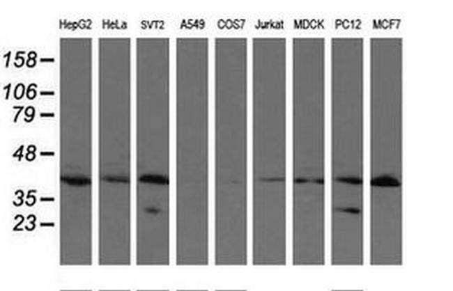 UBE2J1 Antibody in Western Blot (WB)