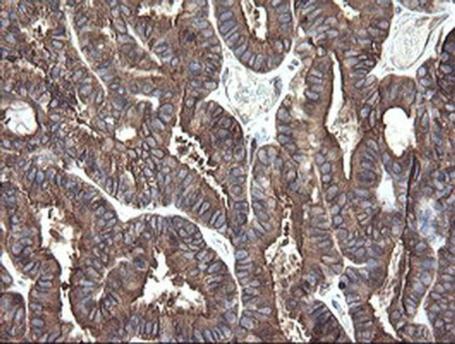 ERp57 Antibody in Immunohistochemistry (Paraffin) (IHC (P))