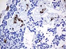 STING Antibody in Immunohistochemistry (Paraffin) (IHC (P))