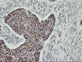 C1orf151 Antibody in Immunohistochemistry (Paraffin) (IHC (P))