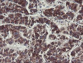 C1orf151 Antibody in Immunohistochemistry (Paraffin) (IHC (P))