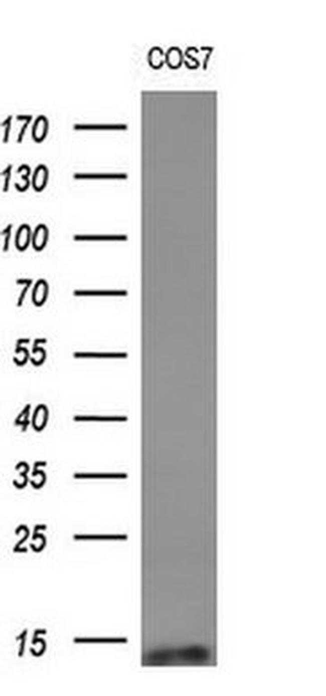 C1orf151 Antibody in Western Blot (WB)