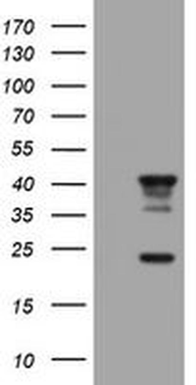 STING Antibody in Western Blot (WB)