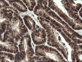 RFC2 Antibody in Immunohistochemistry (Paraffin) (IHC (P))