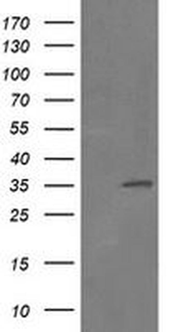 RFC2 Antibody in Western Blot (WB)