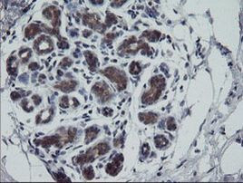 Rhotekin Antibody in Immunohistochemistry (Paraffin) (IHC (P))