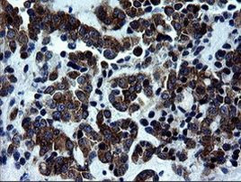 Rhotekin Antibody in Immunohistochemistry (Paraffin) (IHC (P))