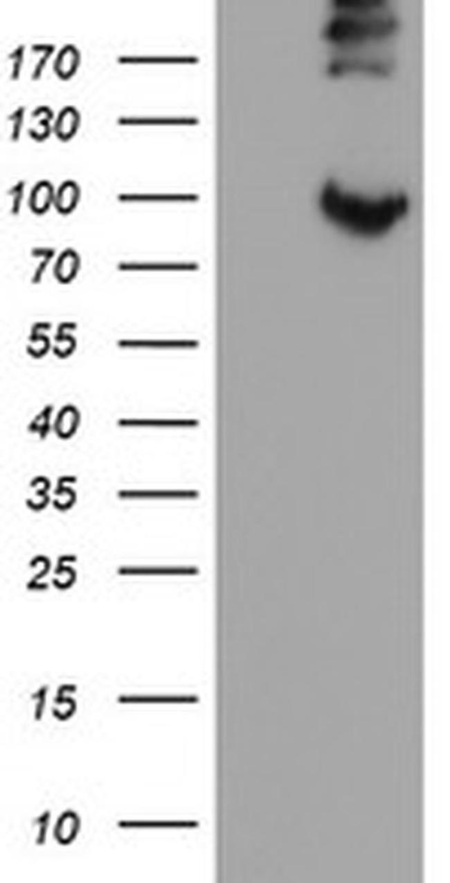 LEPRE1 Antibody in Western Blot (WB)