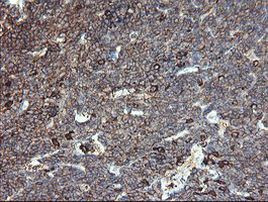 CLEC4E Antibody in Immunohistochemistry (Paraffin) (IHC (P))