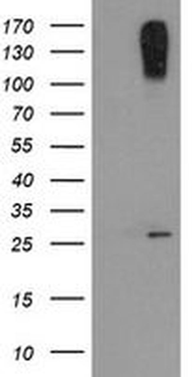 CLEC4E Antibody in Western Blot (WB)