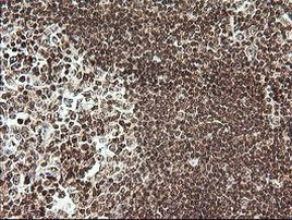 Rhotekin Antibody in Immunohistochemistry (Paraffin) (IHC (P))