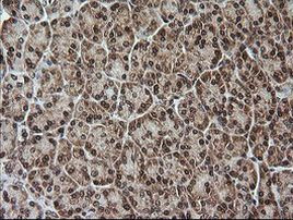 Rhotekin Antibody in Immunohistochemistry (Paraffin) (IHC (P))