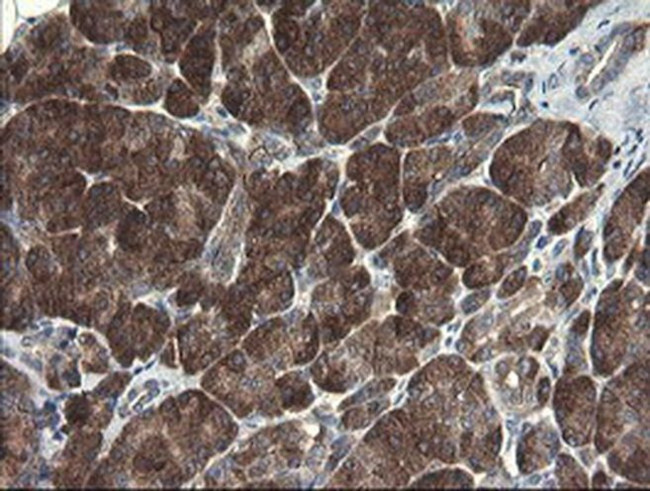 POLR3C Antibody in Immunohistochemistry (Paraffin) (IHC (P))