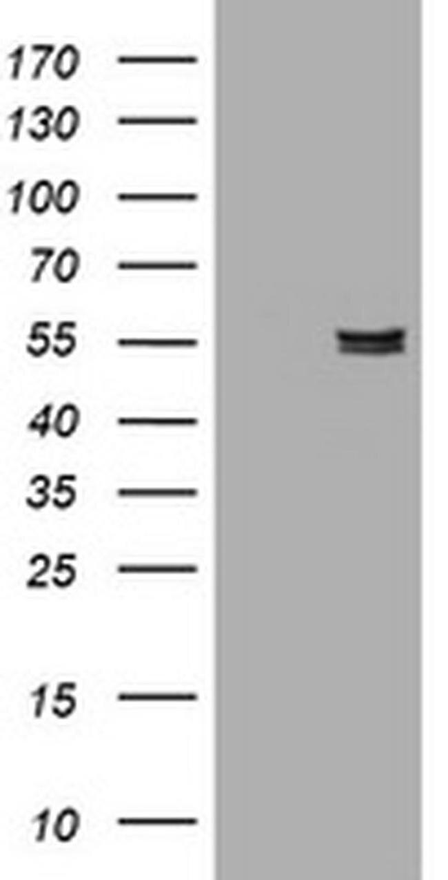 alpha Amylase 2B Antibody in Western Blot (WB)