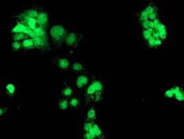 CHN1 Antibody in Immunocytochemistry (ICC/IF)