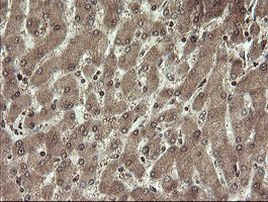 CHN1 Antibody in Immunohistochemistry (Paraffin) (IHC (P))