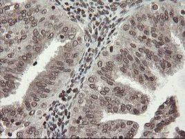 CHN1 Antibody in Immunohistochemistry (Paraffin) (IHC (P))