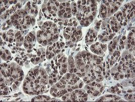 CHN1 Antibody in Immunohistochemistry (Paraffin) (IHC (P))