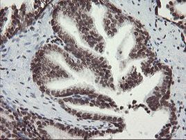 CHN1 Antibody in Immunohistochemistry (Paraffin) (IHC (P))