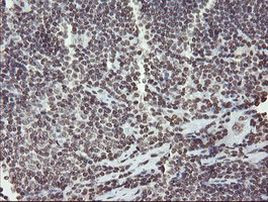 CHN1 Antibody in Immunohistochemistry (Paraffin) (IHC (P))