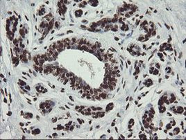 CHN1 Antibody in Immunohistochemistry (Paraffin) (IHC (P))