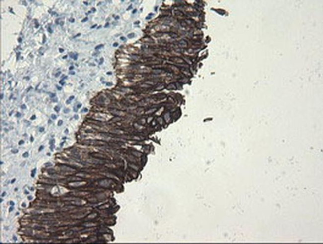 SLA2 Antibody in Immunohistochemistry (Paraffin) (IHC (P))