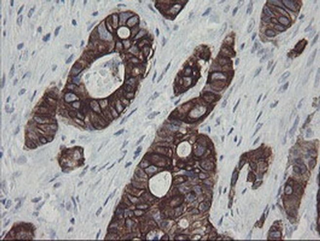 SLA2 Antibody in Immunohistochemistry (Paraffin) (IHC (P))