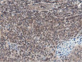 OTUB1 Antibody in Immunohistochemistry (Paraffin) (IHC (P))