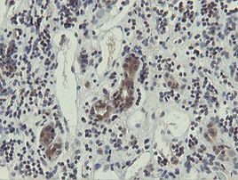 OTUB1 Antibody in Immunohistochemistry (Paraffin) (IHC (P))