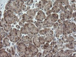 OTUB1 Antibody in Immunohistochemistry (Paraffin) (IHC (P))