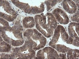 OTUB1 Antibody in Immunohistochemistry (Paraffin) (IHC (P))