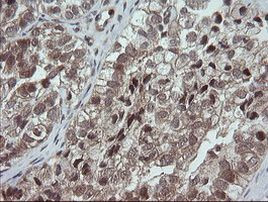 OTUB1 Antibody in Immunohistochemistry (Paraffin) (IHC (P))