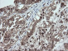 OTUB1 Antibody in Immunohistochemistry (Paraffin) (IHC (P))