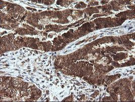 STK38L Antibody in Immunohistochemistry (Paraffin) (IHC (P))