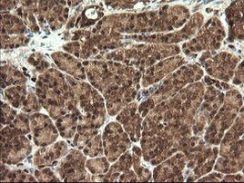 STK38L Antibody in Immunohistochemistry (Paraffin) (IHC (P))