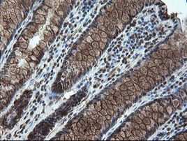 STK38L Antibody in Immunohistochemistry (Paraffin) (IHC (P))