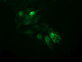 UBE2S Antibody in Immunocytochemistry (ICC/IF)