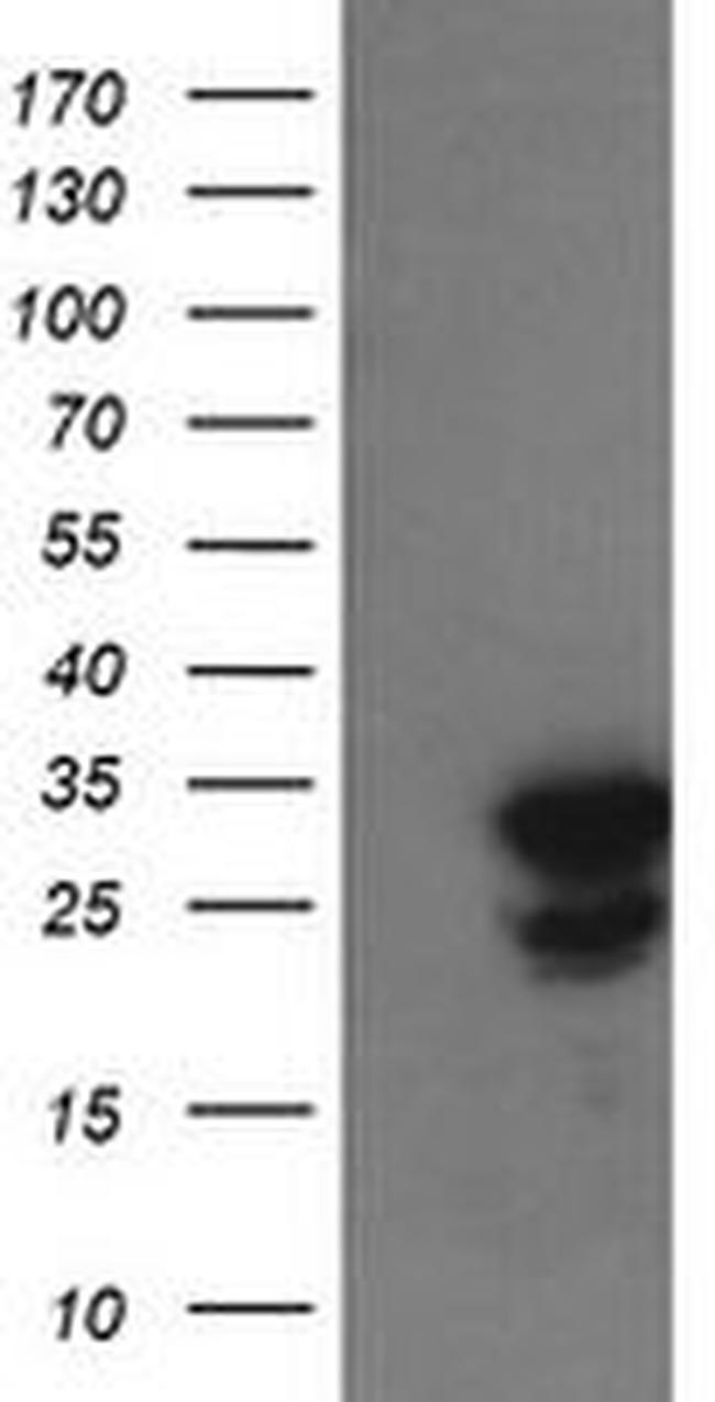 UBE2S Antibody in Western Blot (WB)