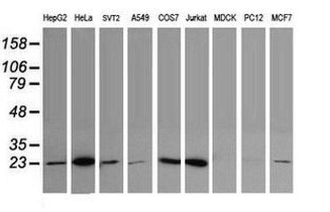 UBE2S Antibody in Western Blot (WB)