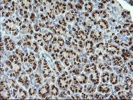 STK38L Antibody in Immunohistochemistry (Paraffin) (IHC (P))